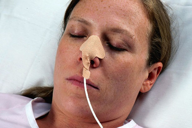 NG Sonda Takılması ve Evde Beslenme Desteği